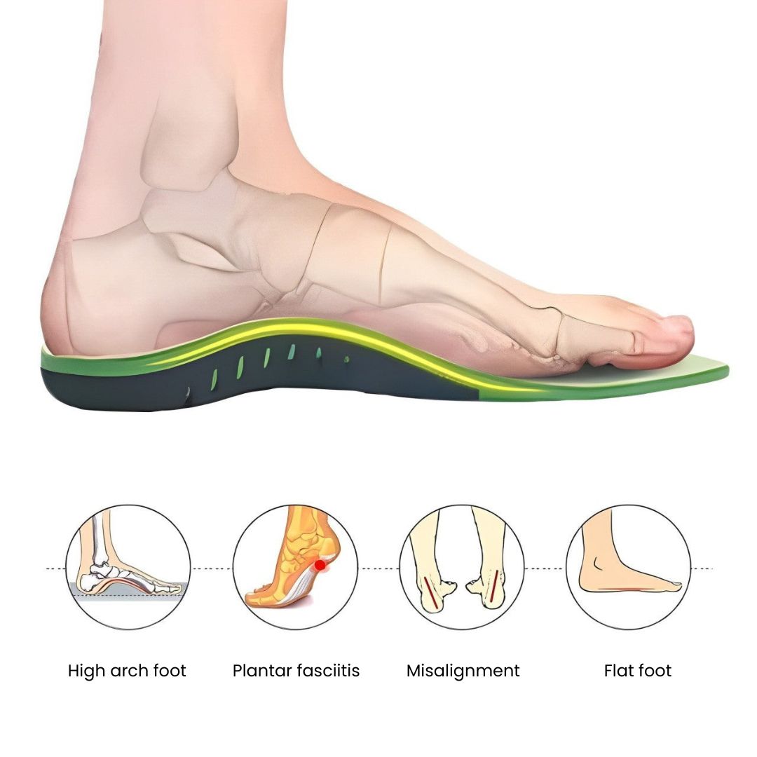 Orthotic Arch Support Insoles: Common Mistakes to Avoid