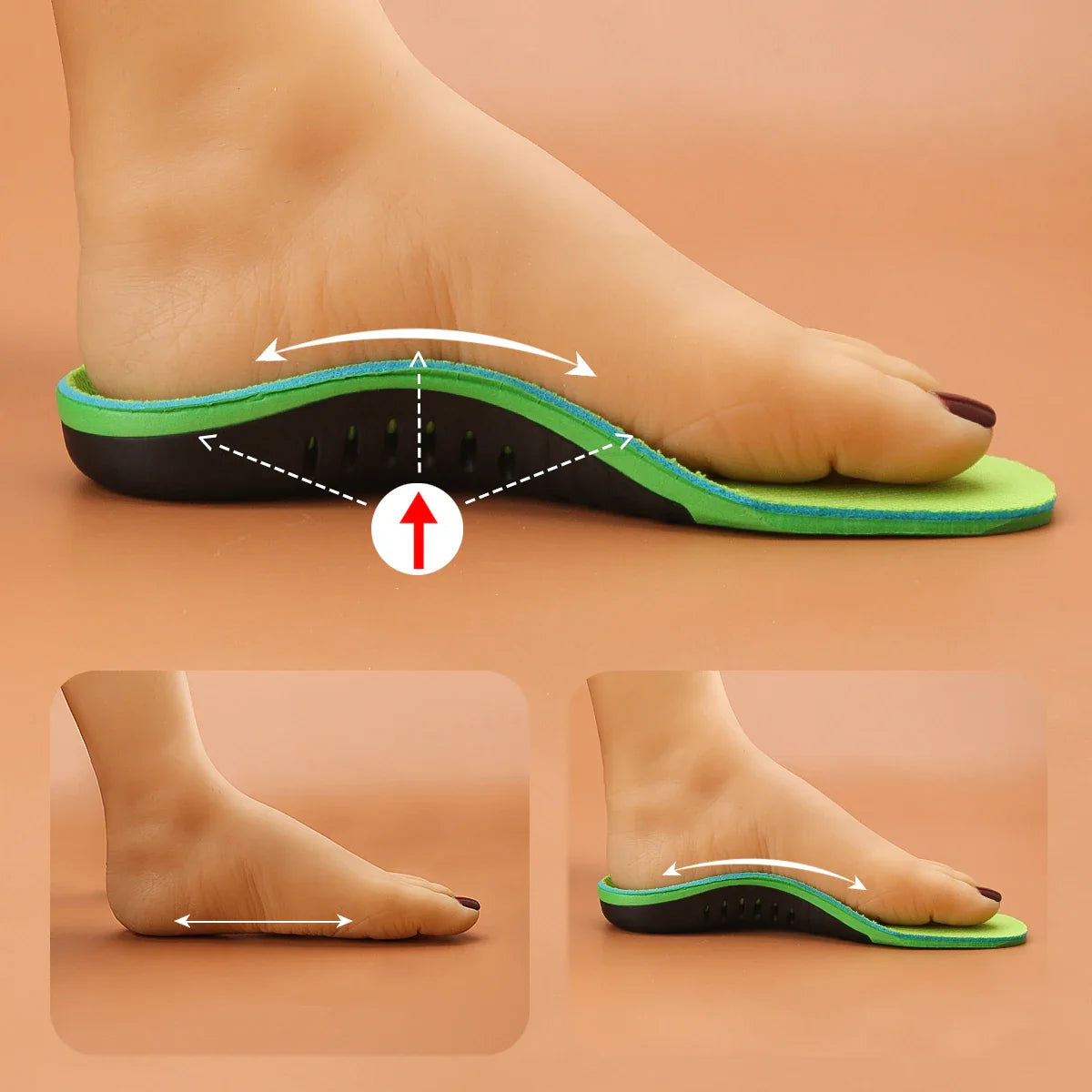 Do Orthotic Insoles Really Fix Supination?